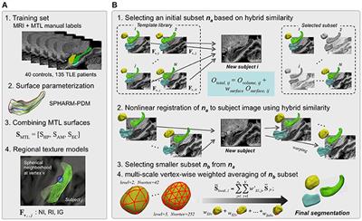 Multi-Template Mesiotemporal Lobe Segmentation: Effects of Surface and Volume Feature Modeling